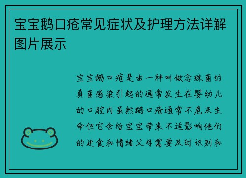 宝宝鹅口疮常见症状及护理方法详解图片展示